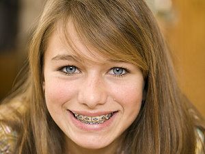 Ein Mädchen mit Zahnspange