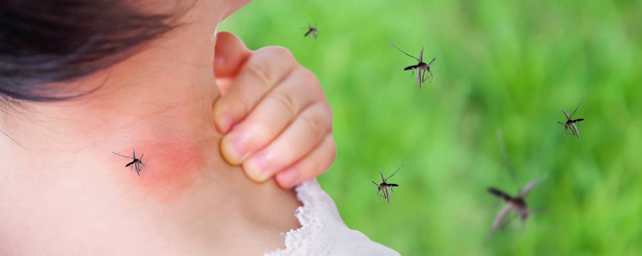 Frau wird von Mücken attakiert und hat Mückenstiche